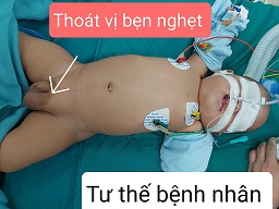 Chuẩn bị tư thế bệnh nhân/benhhocnam.com
